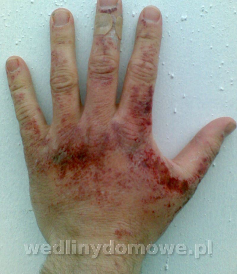 post-40314-0-57003700-1611920513_thumb.jpg
