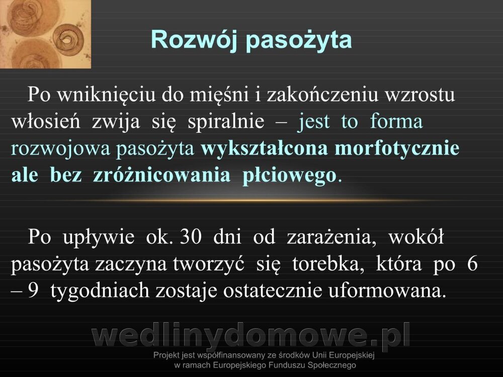 Włośnica - marzec 2014rPPTX (1)_011.jpg