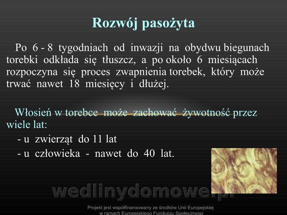 Włośnica - marzec 2014rPPTX (1)_012.jpg