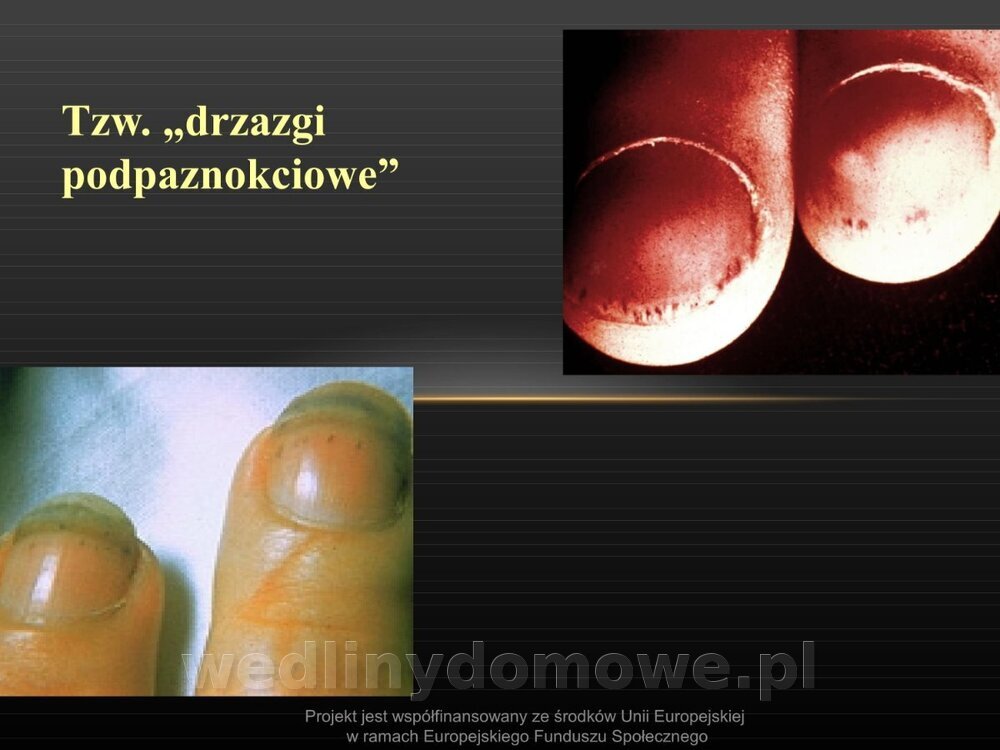 Włośnica - marzec 2014rPPTX (1)_100.jpg